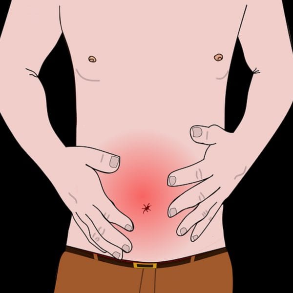 Pancreatitis Aguda