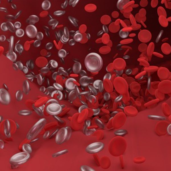 Tromboembolismo Pulmonar